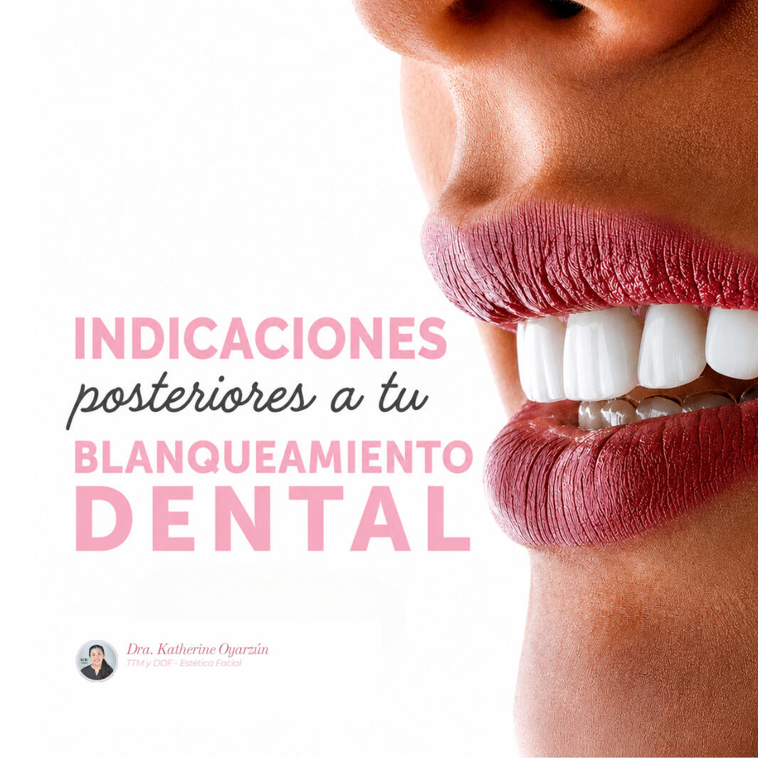 BLANQUEAMIENTO